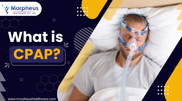 What is CPAP?